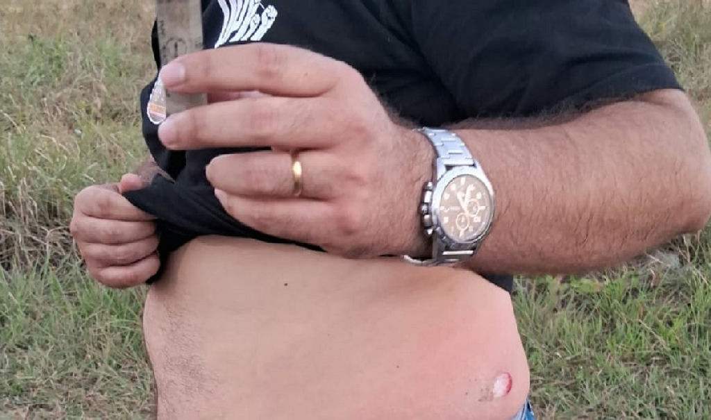 Polícia Militar investiga disparo de bala de borracha contra candidato ao governo da Bahia
